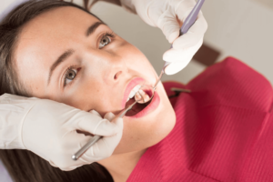 Tratamento Dentario Fechamento de Diastema Dra. Adriana Koeppel