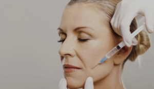 Botox em Belo Horizonte
