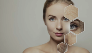Botox em Belo Horizonte