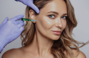 Harmonização facial bigode chinês em Belo Horizonte