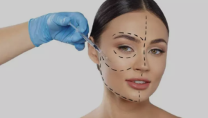 Harmonização Facial em Belo Horizonte: Dói?