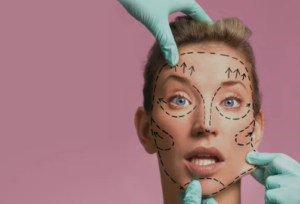 Harmonização facial em Belo Horizonte
