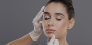 Harmonização facial em Belo Horizonte