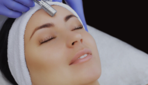 Harmonização Facial Feminina em Belo Horizonte