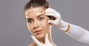 Harmonização facial passo a passo em Belo Horizonte