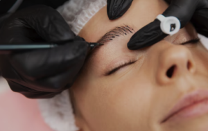Harmonização facial sobrancelhas em Belo Horizonte