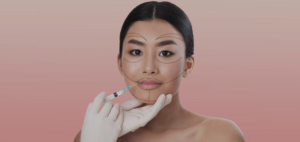 Harmonização facial técnicas em Belo Horizonte