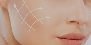 Harmonização Facial em Belo Horizonte: Um Guia Completo