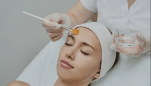 Peeling Químico em Belo Horizonte - Dra. Adriana Koeppel