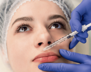 Preenchimento Labial em Belo Horizonte - Dra. Adriana Koeppel