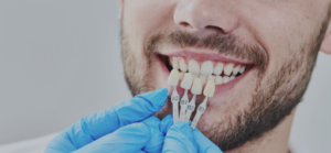 Restaurações Estéticas | Fratura Dental em Belo Horizonte - Dra. Adriana Koeppel