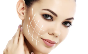 Harmonização facial com ácido hialurônico em Belo Horizonte