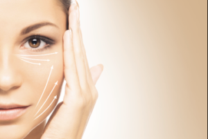 Harmonização facial com fios em BH MG