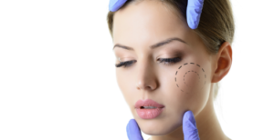 Harmonização facial convênio em Belo Horizonte