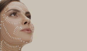 Harmonização facial linhas de expressão em Belo Horizonte