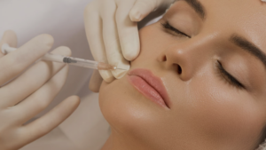 Harmonização facial linhas de expressão em Belo Horizonte