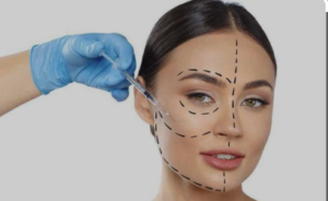 Harmonização facial mitos e verdades em Belo Horizonte