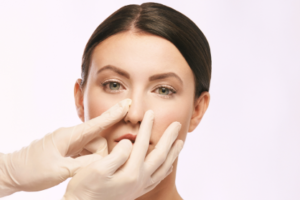 Harmonização facial orçamento em BH MG