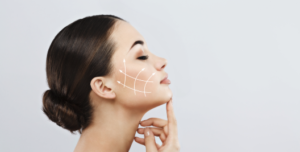 Harmonização facial para levantar as sobrancelhas em Belo Horizonte