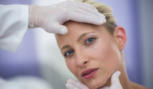 Harmonização facial para mulheres em Belo Horizonte