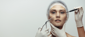 Harmonização facial sem cirurgia em Belo Horizonte
