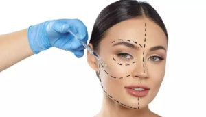 Onde Encontrar Harmonização Orofacial de Qualidade em Belo Horizonte