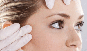 5 Mitos E Verdades Sobre A Harmonização Orofacial Em Belo Horizonte