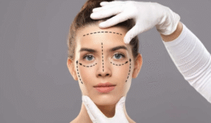 Desvende Os Segredos Da Harmonização Facial E Rejuvenesça Em Belo Horizonte