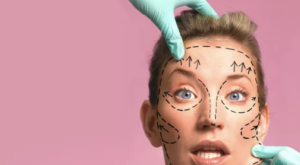 Especialista em Harmonização Facial no Lourdes BH: Rejuvenesça Com Qualidade