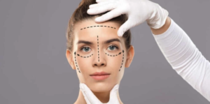 Especialistas em Harmonização Facial: Antes e Depois em Belo Horizonte