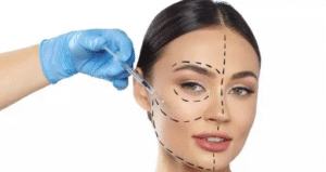 Harmonização Facial Em BH: Promoções E Descontos Exclusivos