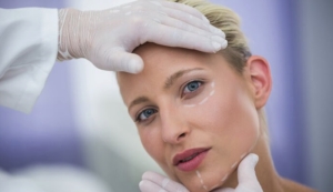 Harmonização Facial: O Que Saber Antes de Fazer o Tratamento?