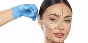 Harmonização Facial em BH: Procedimentos Minimamente Invasivos