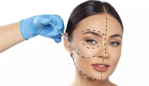 Harmonização Orofacial: Como Escolher o Melhor Procedimento Para Você?