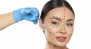 Harmonização Orofacial: Um Investimento Em Seu Bem-Estar E Autoestima