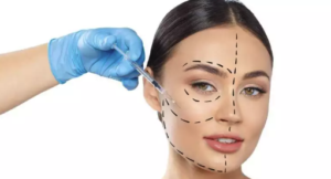 Harmonização Orofacial em Betim: Encontre Seu Dentista Idea