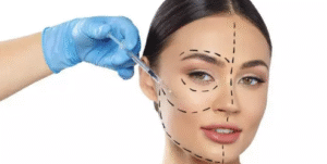Clareamento Dental: Transforme Seu Sorriso em Belo Horizonte
