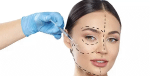 Clareamento Dental a Laser em Belo Horizonte