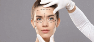 Dentista Especialista em Estética Dental em BH Facetas e Lentes