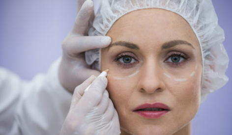 Facetas Dentais em Belo Horizonte: Durabilidade e Estética Impecável