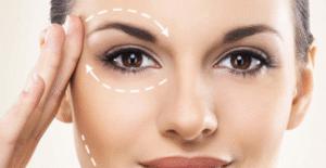 Facetas Dentais em Belo Horizonte: Durabilidade e Estética Impecável