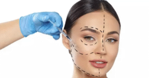 Harmonização Facial Em BH: Presenteie-se Com Autoestima Neste Mês