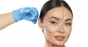 Harmonização Facial Savassi BH | Rejuvenescimento Facial
