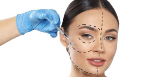 Harmonização Orofacial Belo Horizonte | Agende Sua Consulta!