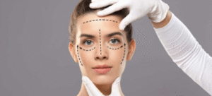 O Guia Definitivo Sobre Harmonização Facial Em Belo Horizonte (BH): Procedimentos, Riscos, E Cuidados