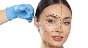  Adeus Dentes Manchados e Desalinhados com Facetas BH