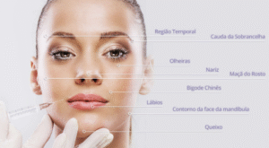  Adeus Dentes Manchados e Desalinhados com Facetas BH