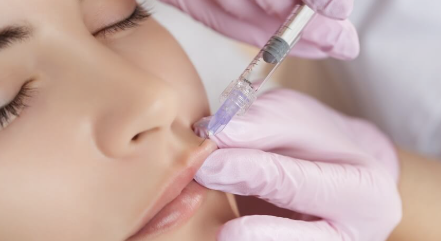 Faceta Dental em Belo Horizonte: Valores e Formas de Pagamento
