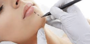 Faceta Dental em Belo Horizonte: Valores e Formas de Pagamento