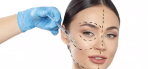  Invista no Seu Sorriso: Facetas e Lentes de Contato em Belo Horizonte